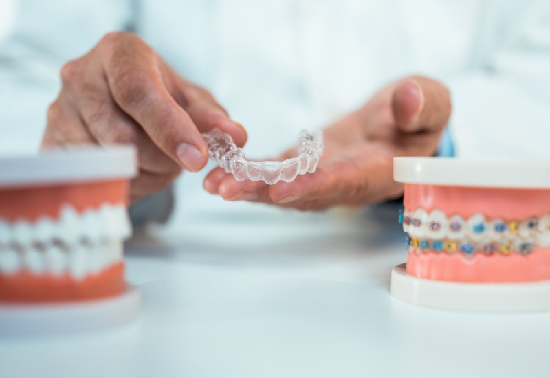 Hands holding an aligner next to dental models, comparing clear & traditional braces in Brookfield